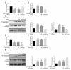 The image shows a series of graphs and Western blot images evaluating the effects of miR-708-5p on IL-1β-induced chondrocyte apoptosis. The graphs display RT-qPCR and Western blot data for Bcl2 and caspase-3 expression levels. The image also includes a Western blot showing the levels of BAX, Cleaved Caspase3, and β-Actin in chondrocytes transfected with miR-708-5p, miR708 inhibitor, and negative control. The data suggests different levels of mRNA and protein expression under various conditions.