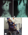 Fig. 4