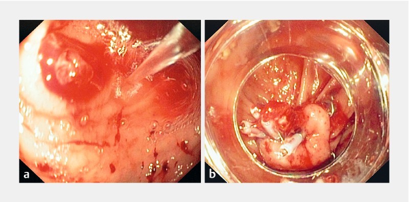 Fig. 1 a 