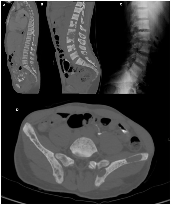 Figure 11