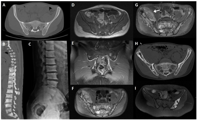 Figure 13