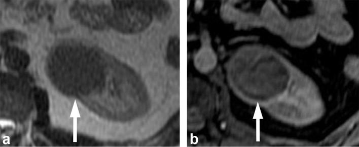 Figure 16. 