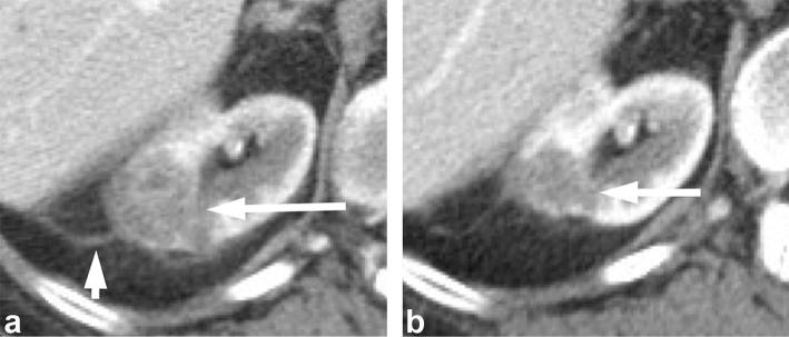 Figure 2. 