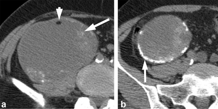 Figure 5. 