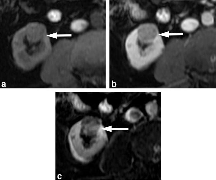 Figure 13. 