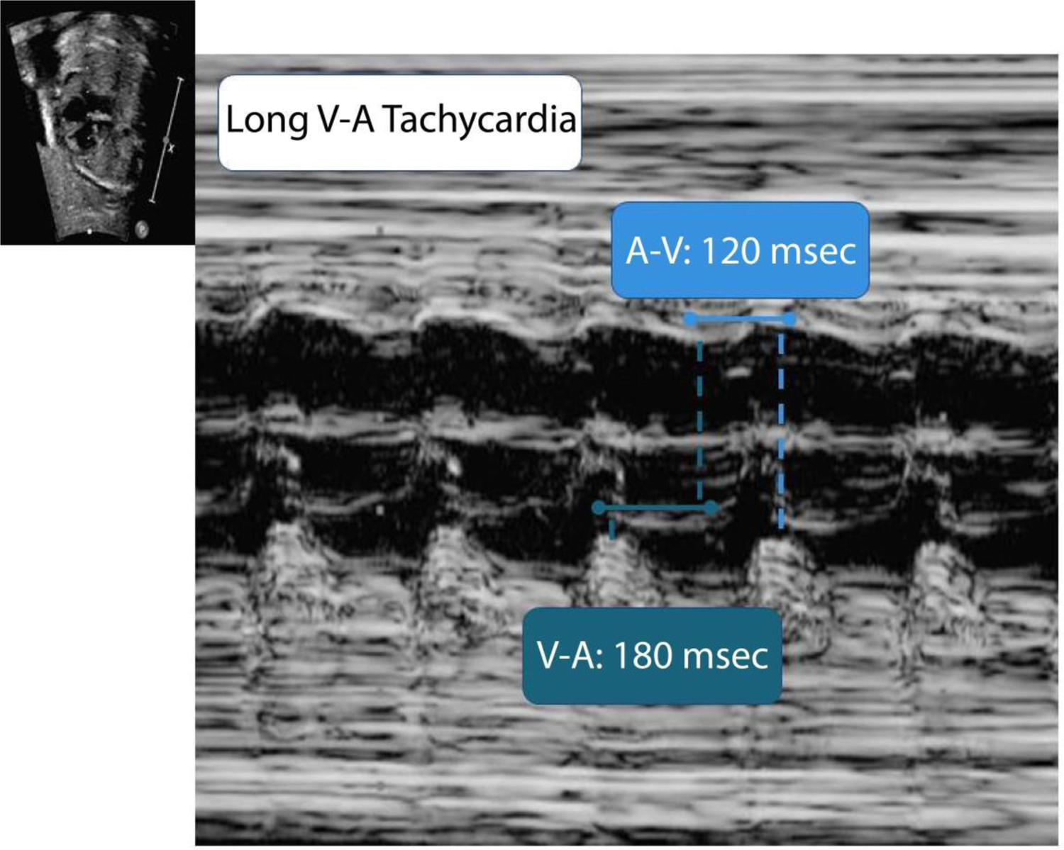 Figure 2: