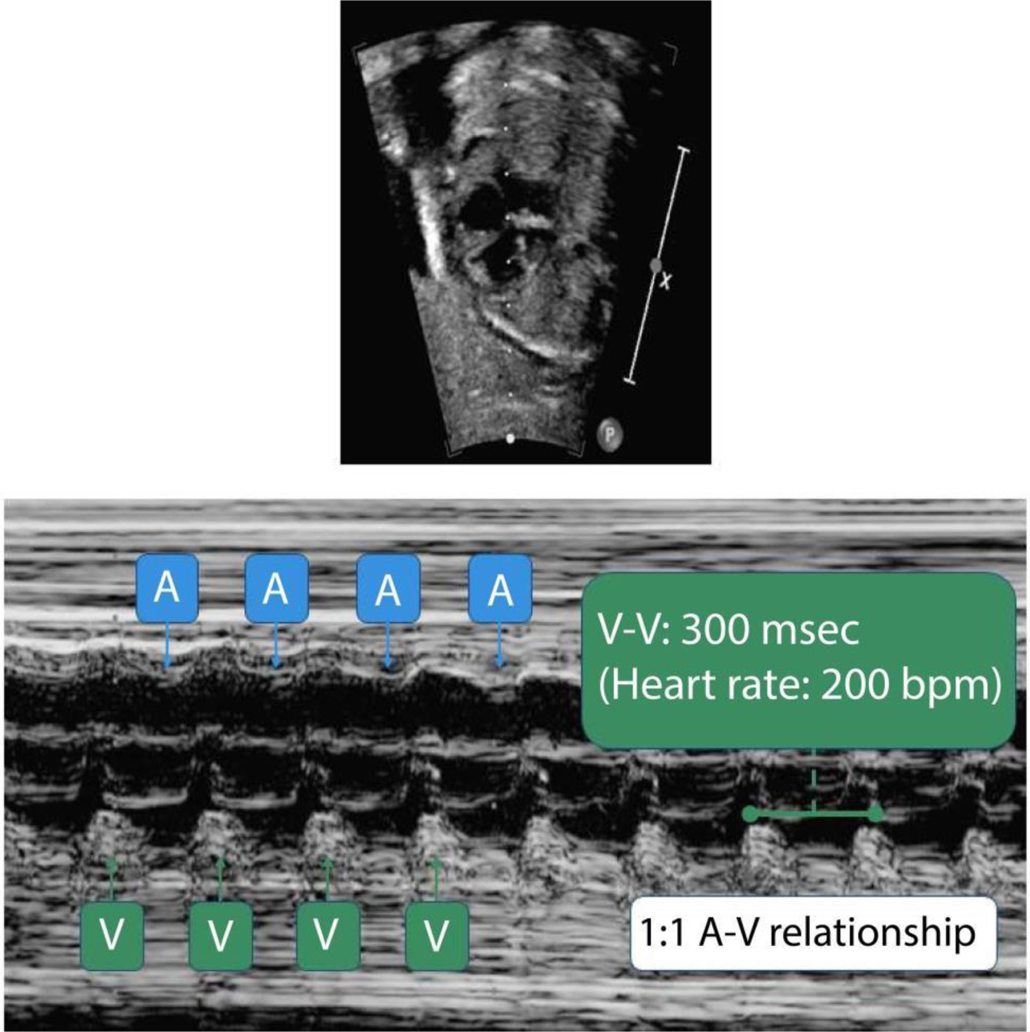 Figure 1: