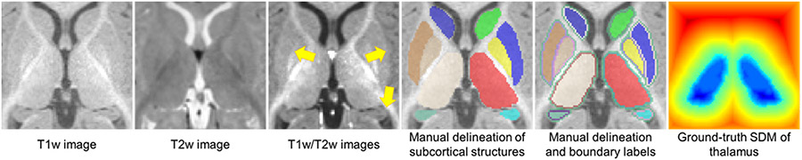 Fig. 1.