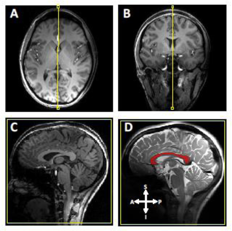 Fig 1.