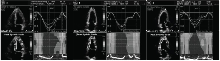 Fig. (2)