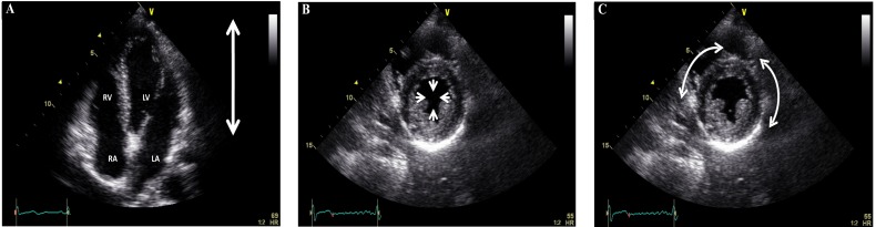 Fig. (1)