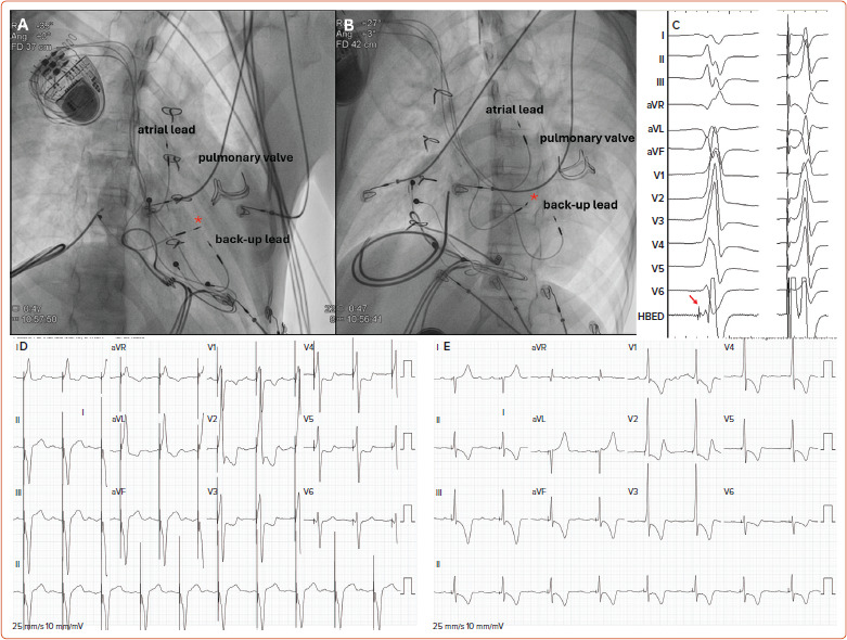 Figure 4: