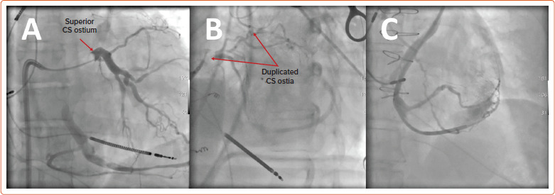 Figure 2: