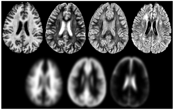 FIG. 1