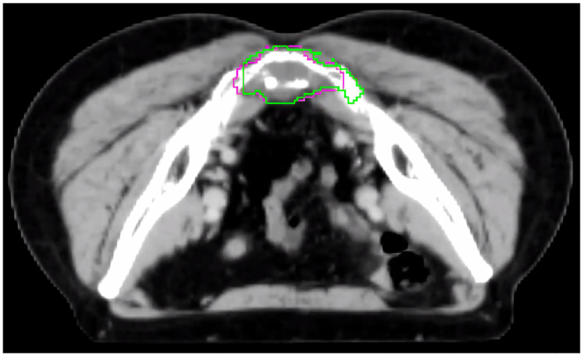 Figure 3a: