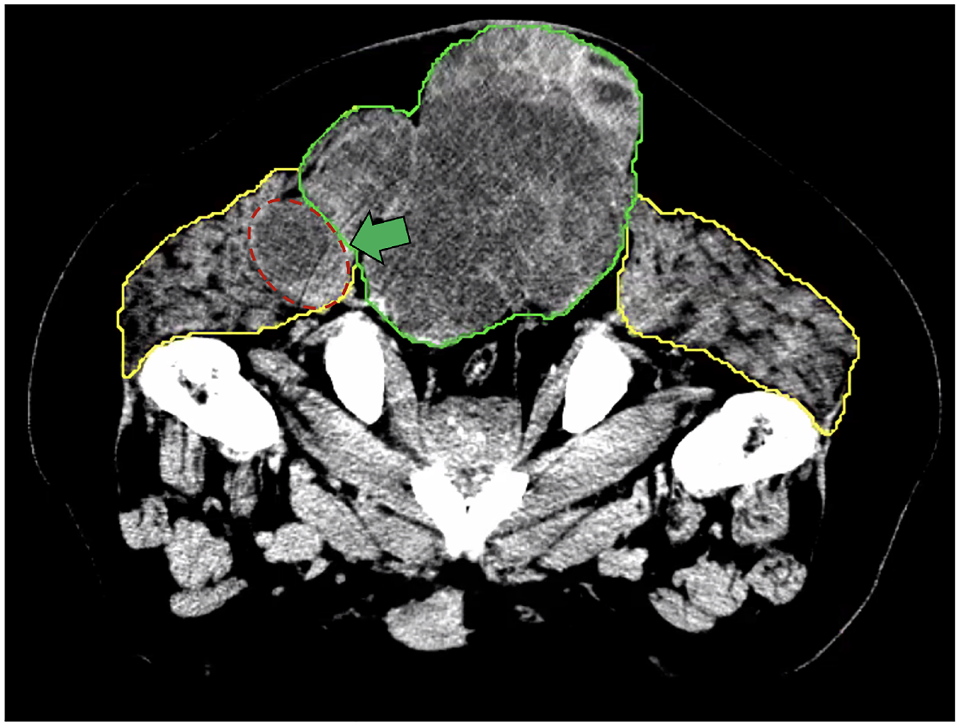 Figure 3b: