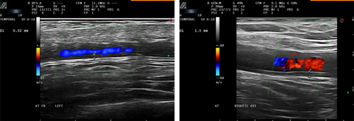 FIGURE 1