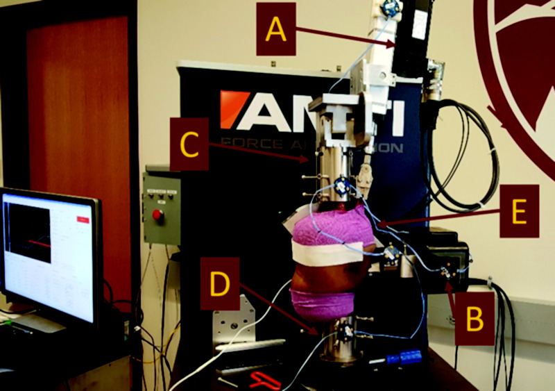 Sagittal view of robotic knee joint simulator setup in the AMTI VIVO, including custom quadriceps mechanism (a) for cadaveric laxity testing. The setup uses rigid body markers (b) fixed to the femur (c), the tibia (d) and the patella (e) for tracking during testing. The quadriceps mechanism, seen as the top actuator (a), is used to apply the passive tension to the patella (e).
