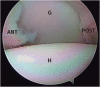 Fig 12