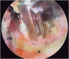 Fig 6