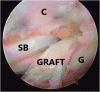 Fig 11