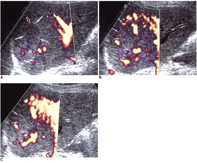 Fig. 11