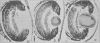 1620