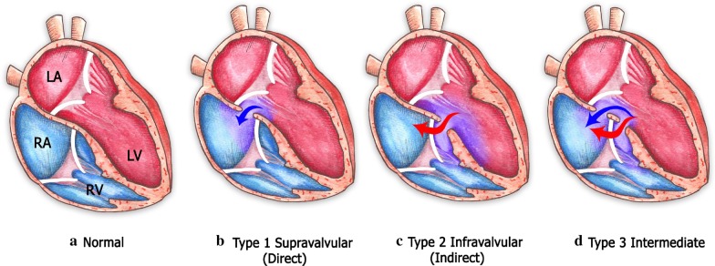 Fig. 10