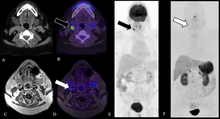 FIG. 3.