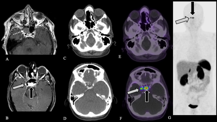 FIG. 2.