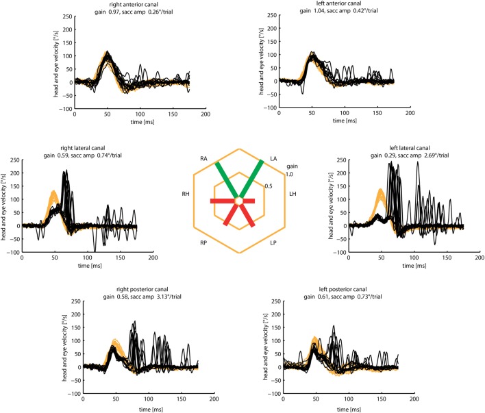 Figure 15