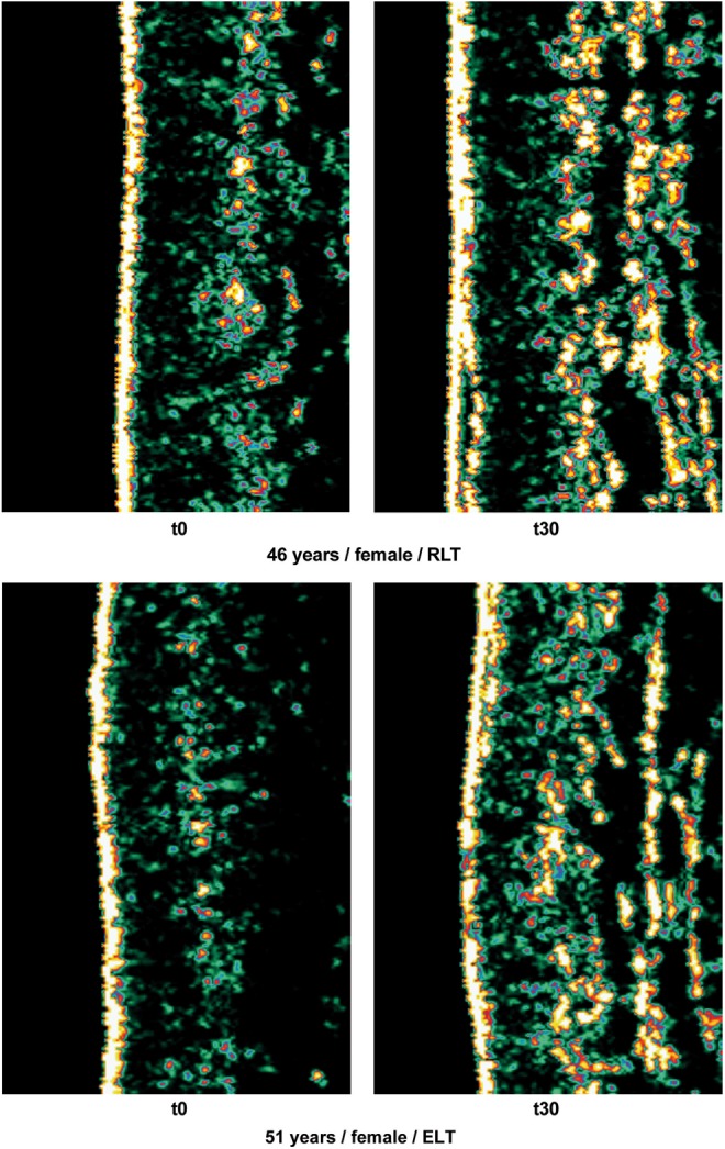 FIG. 2.