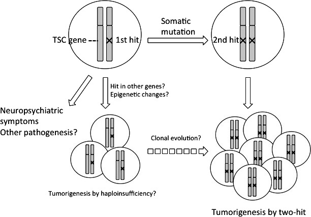 Mourning Dr. Alfred G. Knudson: the two‐hit hypothesis, tumor ...