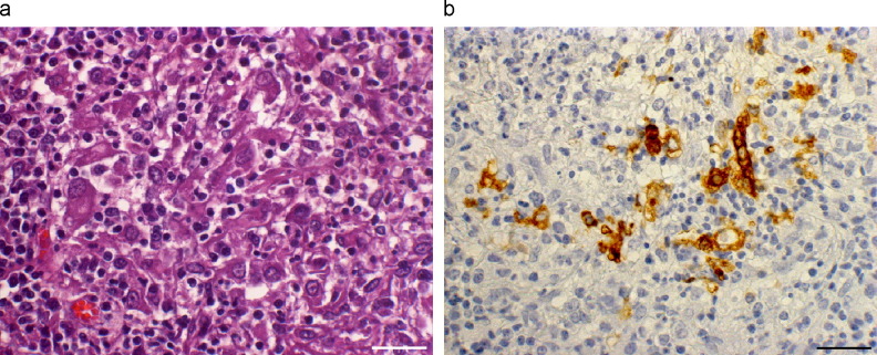 Fig. 1a,b