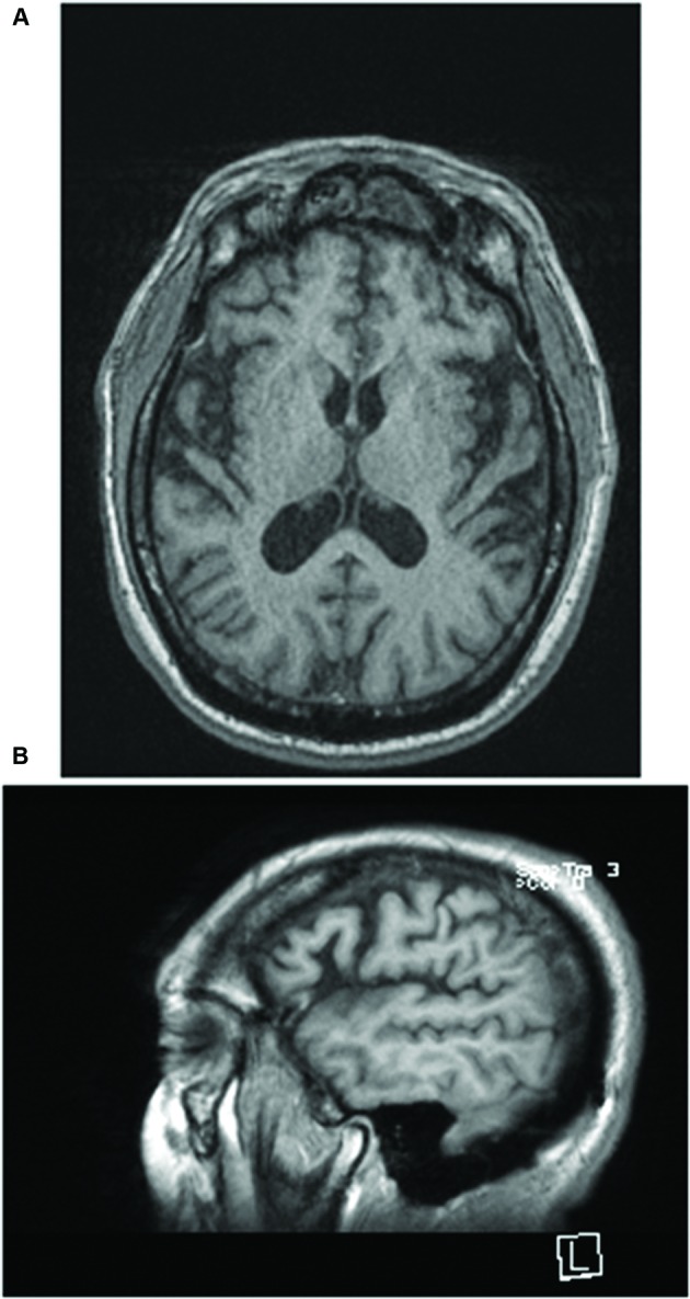 FIGURE 1