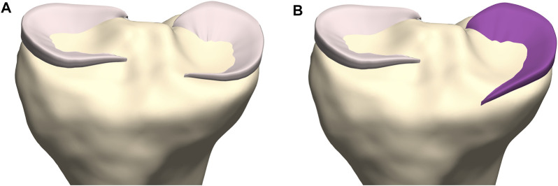 FIGURE 14