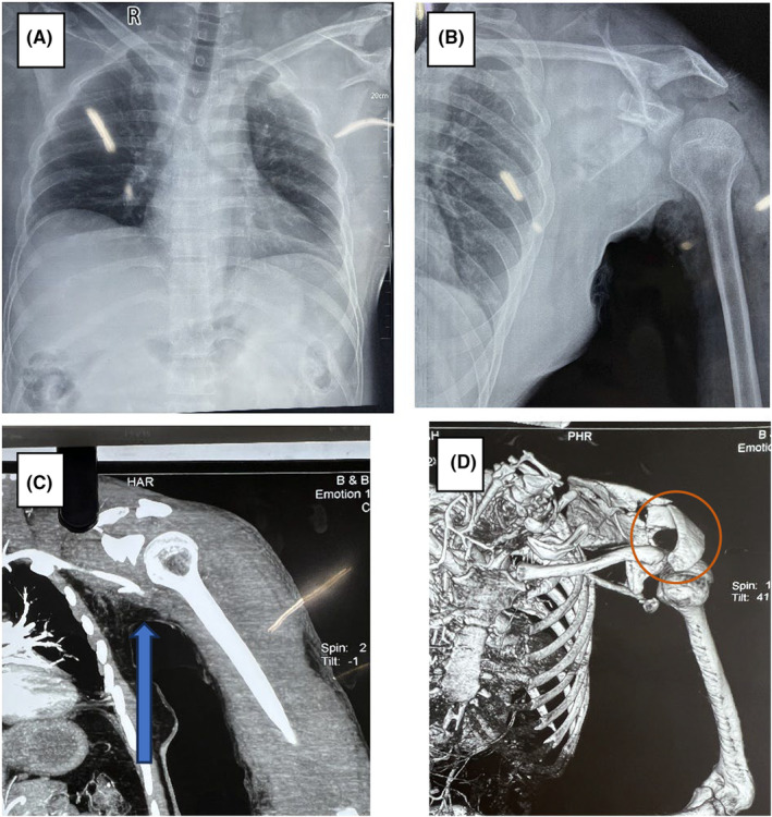 FIGURE 2