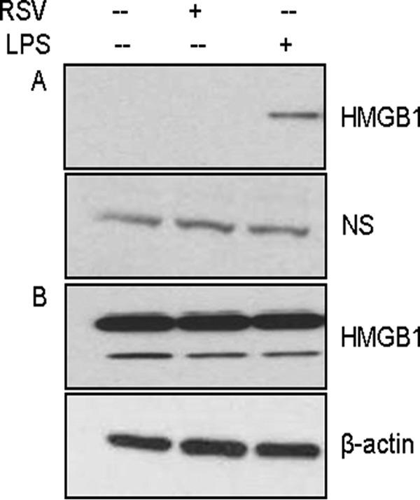 FIG 11