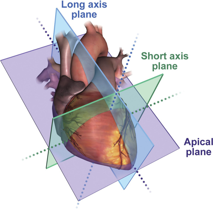 Standard imaging planes. Drawing shows the four standard planes: long axis, short axis, apical four chamber, and apical two chamber. The long-axis plane corresponds to images acquired in the parasternal long-axis view, and the short-axis plane corresponds to images acquired in the parasternal short-axis view. The apical plane (both four chamber and two chamber) corresponds to images acquired from the apical window. (Reprinted, with permission, from reference 9.)