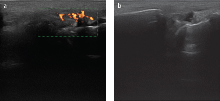 Figure 1. a, b