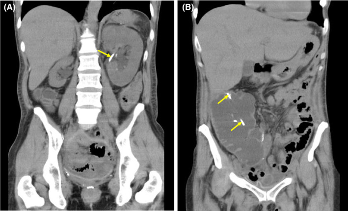 FIGURE 1