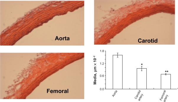 Figure 2B