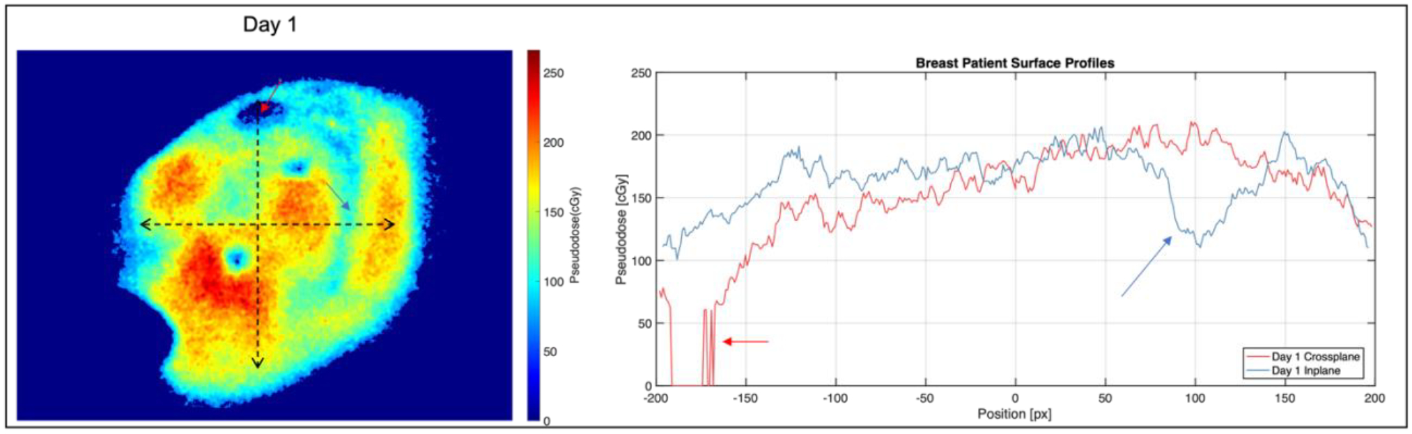 Figure 11.