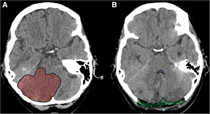 Fig. 4