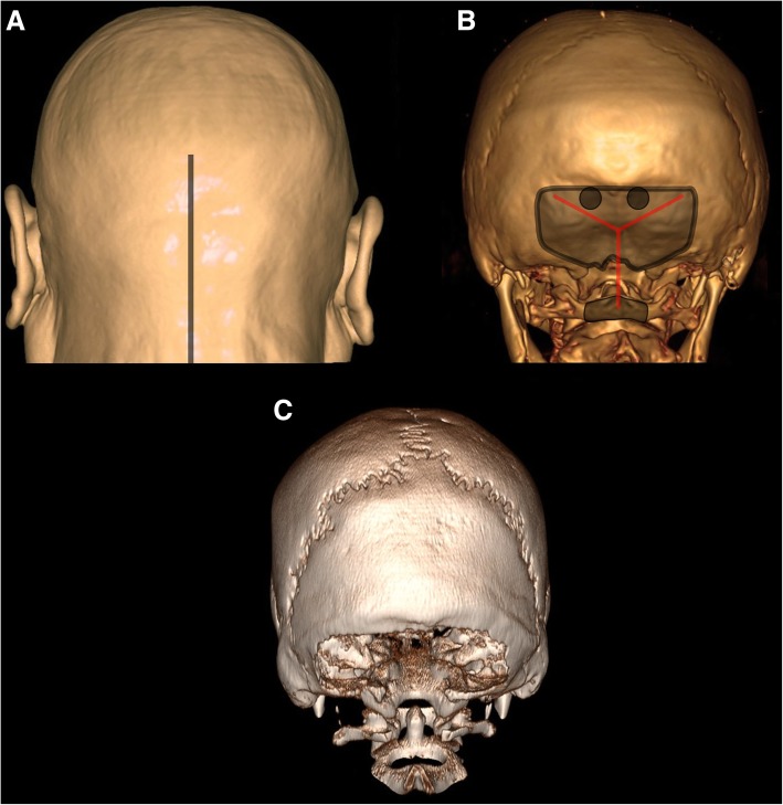 Fig. 5