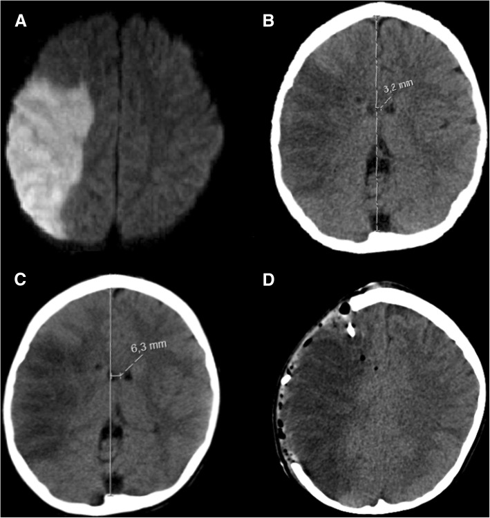 Fig. 10