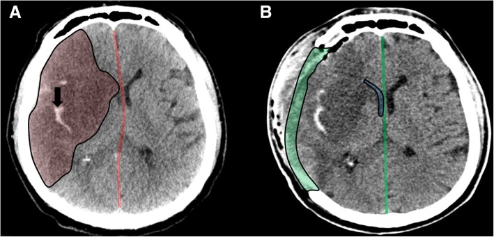 Fig. 2