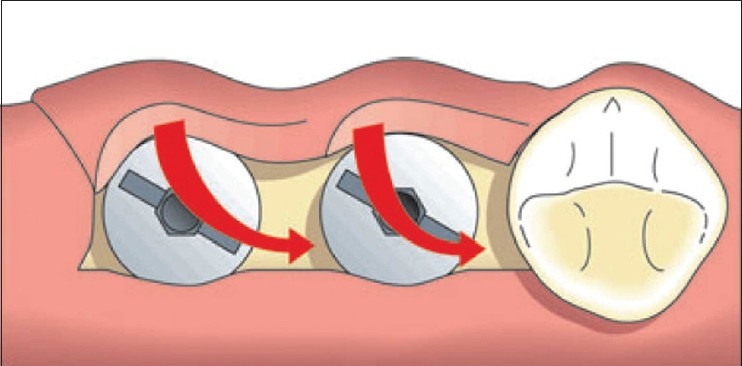 Figure 1b