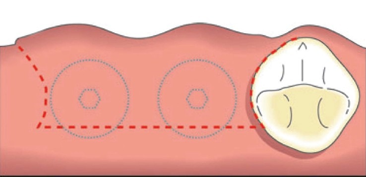 Figure 1a