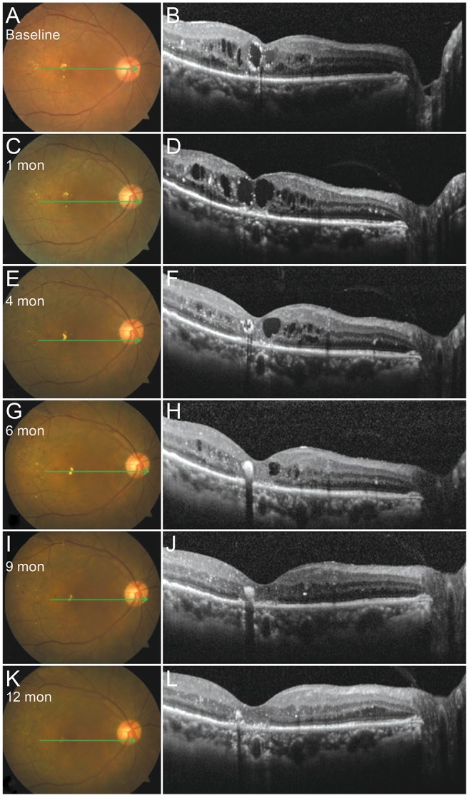 Fig. 2